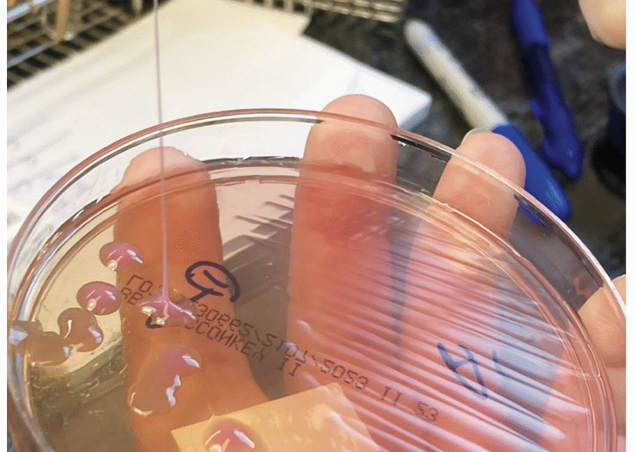 this-may-be-the-grossest-eye-pic-ever—but-the-cause-is-what’s-truly-horrifying